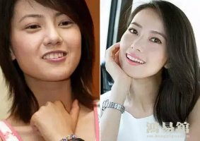 b型血女人的性格特点 B型血女生性格解析